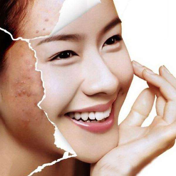 肌肤的温柔絮语:关于保湿的缱绻告白