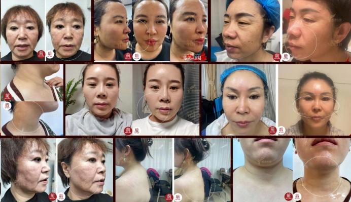 对抗时光痕迹：科学抗皱的多维探索