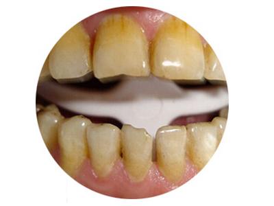 那抹亮白，是藏在笑容里的星光