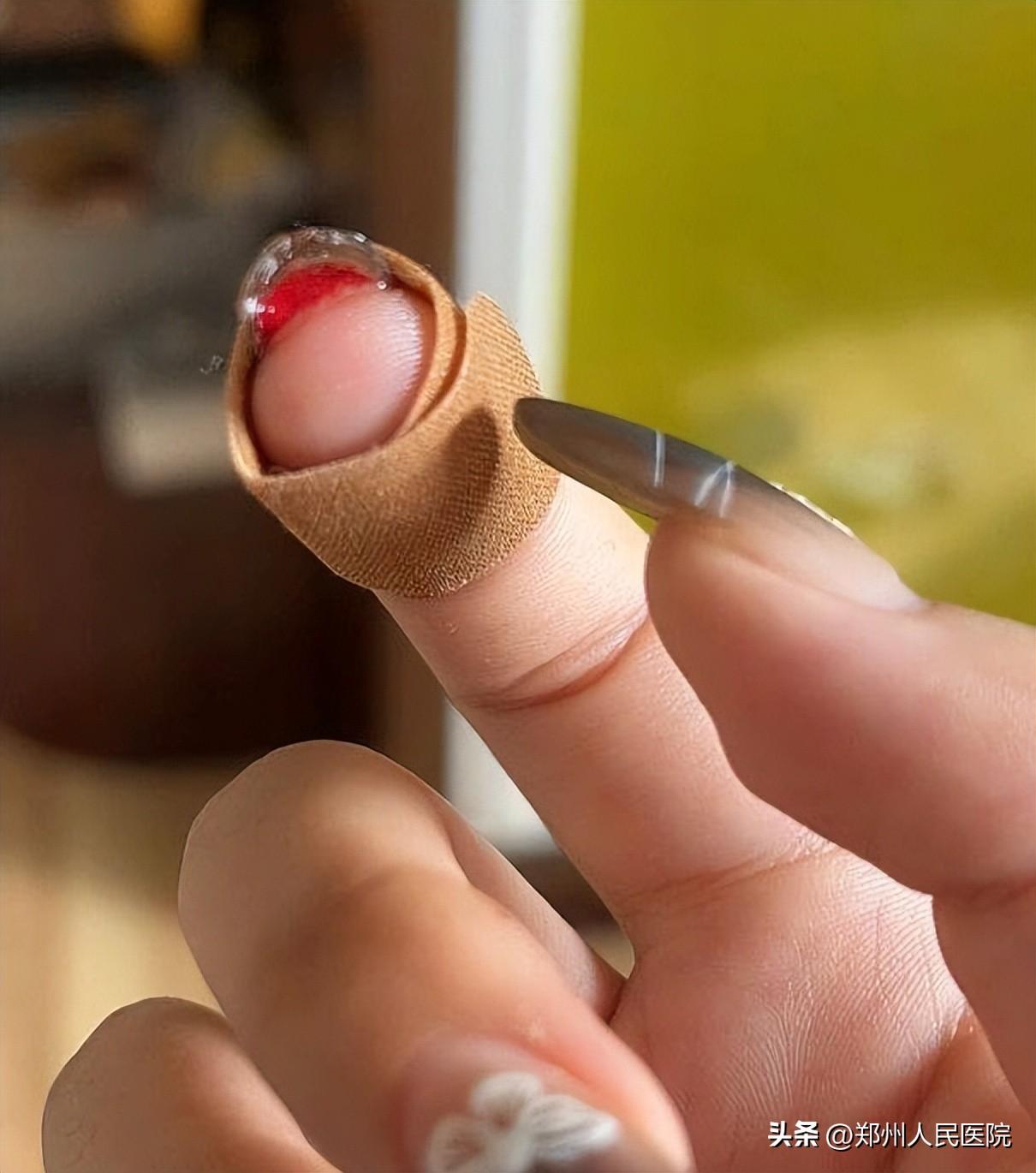 美甲会伤害指甲吗？