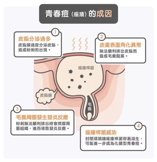 肌肤的突围战:科学解析痤疮成因与护理之道