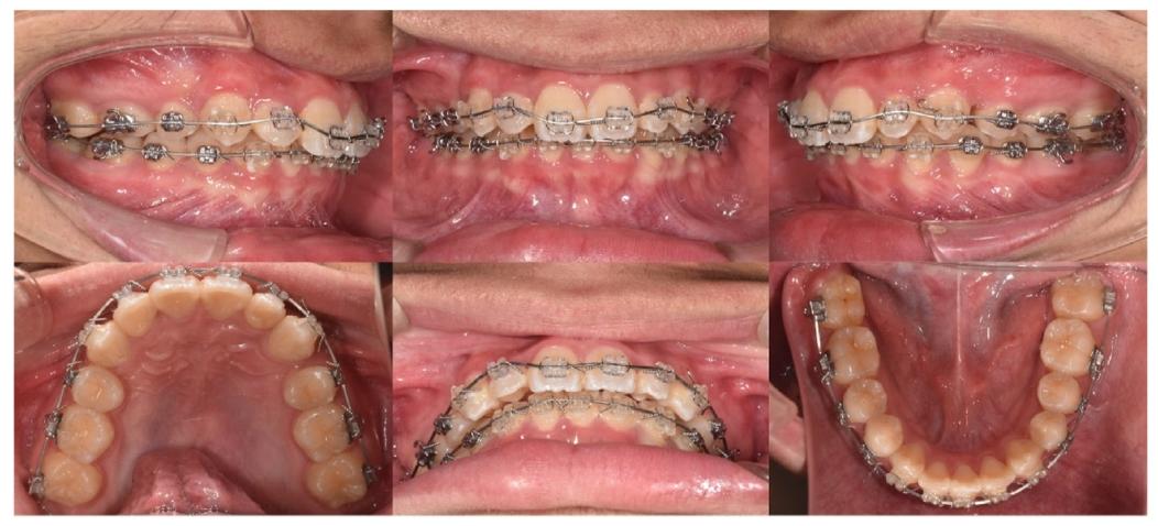 图7. Period of active treatment: 22th months